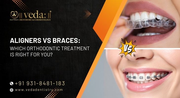 Aligners vs Braces: Which Orthodontic Treatment Is Right for You?