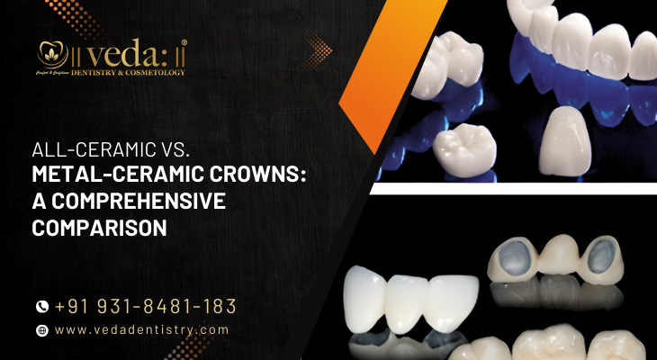 The Role of Digital Smile Design in Getting It Right