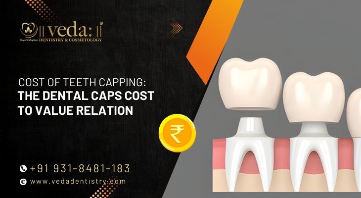 Cost of Teeth Capping: The Dental Caps Cost–to–Value Relation