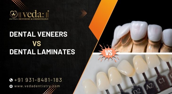 Dental Veneers vs Dental Laminates – What’s the Real Difference?