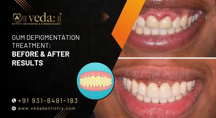 The Role of Digital Smile Design in Getting It Right