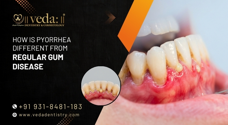 The Role of Digital Smile Design in Getting It Right