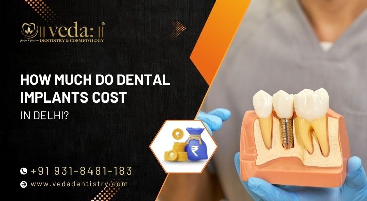 How Much Do Dental Implants Cost in Delhi?