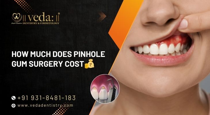 How Much Does Pinhole Gum Surgery Cost?
