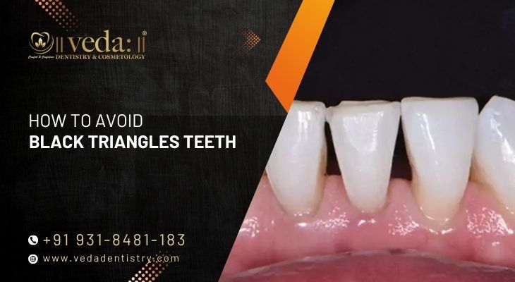 The Role of Digital Smile Design in Getting It Right