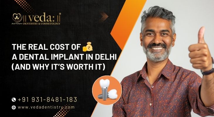 Dental Implant in Delhi