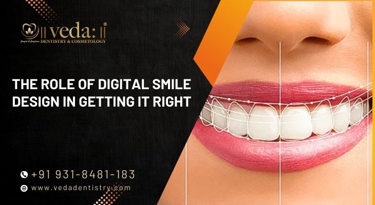 The Role of Digital Smile Design in Getting It Right