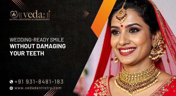 Wedding-Ready Smile Without Damaging Your Teeth