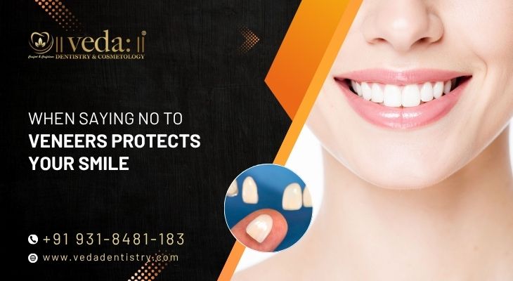 When Saying No to Veneers Protects Your Smile