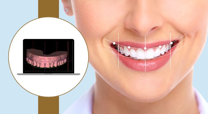3D Smile Designing in Delhi