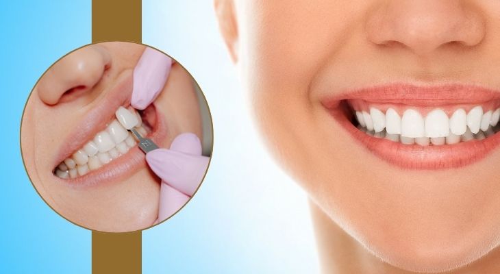 Best Cosmetic Dentist in Delhi