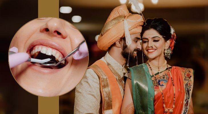 Bridal Dental Treatment in Delhi 