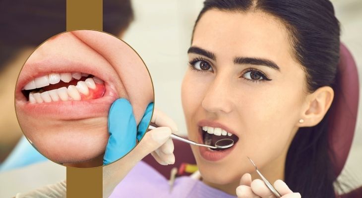 Dental Curettage Treatment