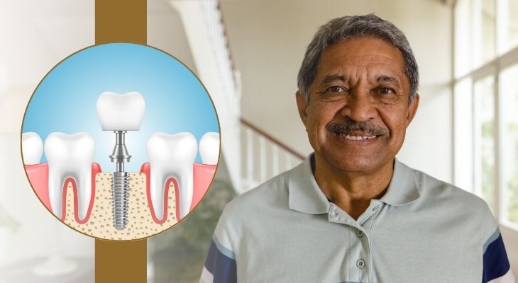 Dental Implant Treatment in Delhi