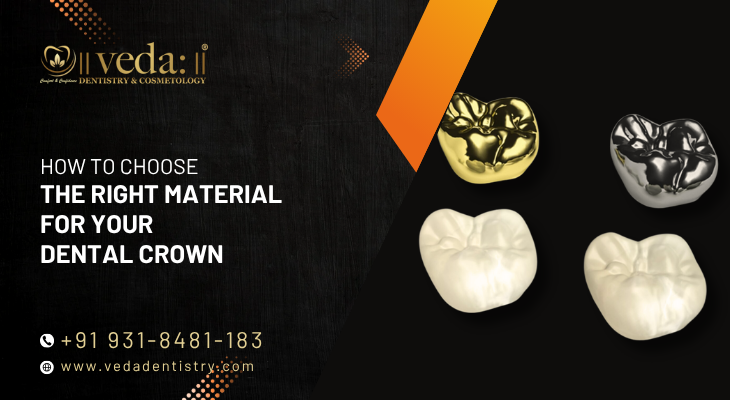 All-on-x Dental Implants in East Delhi