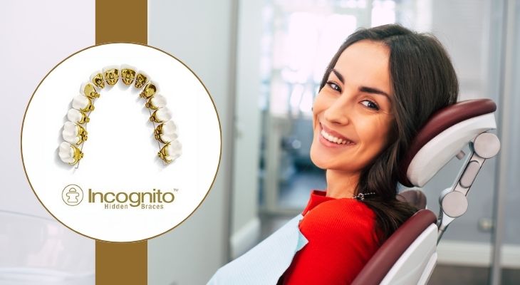 Incognito Lingual Braces in Delhi 