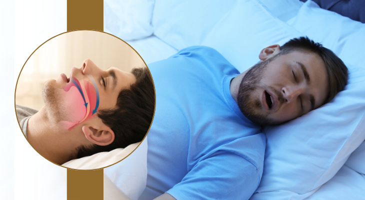 Sleep Apnea Treatment