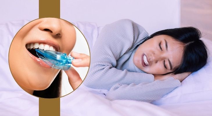 Bruxism Treatment – Say Goodbye to Teeth Grinding