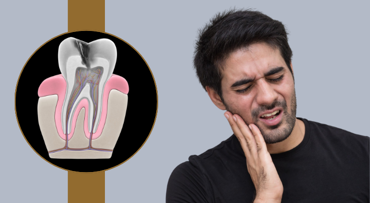 Toothache Treatment