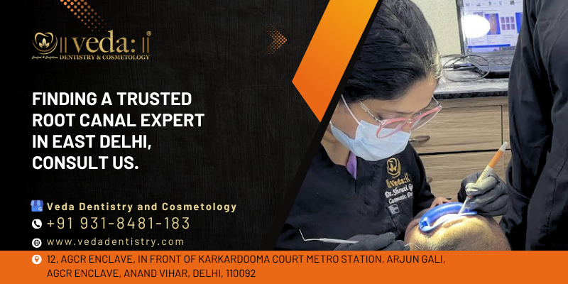 root canal expert east delhi
