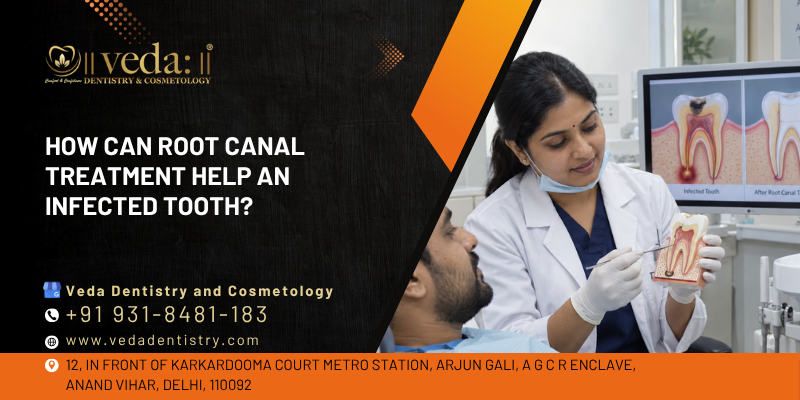 root canal treatment near me
