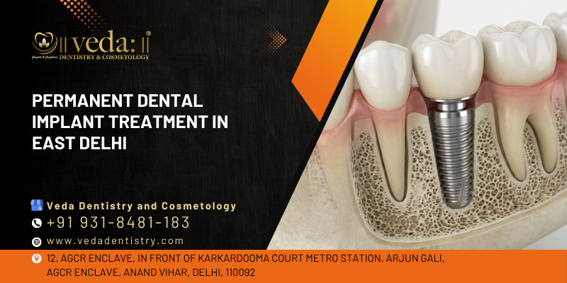 dental implant treatment in east delhi