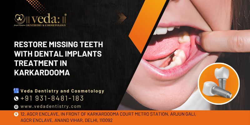 dental implant treatment in karkardooma