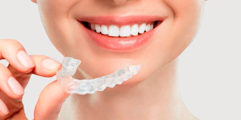 Searching for Invisalign Braces in Vaishali Delhi? Visit Us.