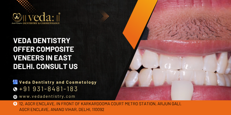 composite veneers in east delhi