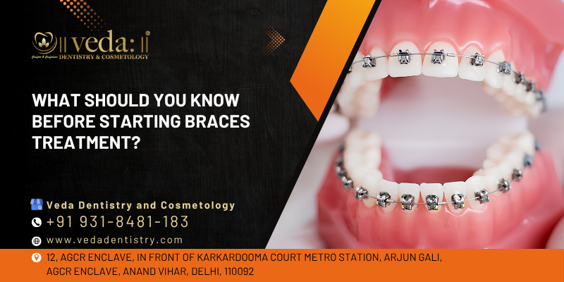 braces treatment near me